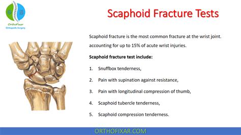 special tests for scaphoid fracture